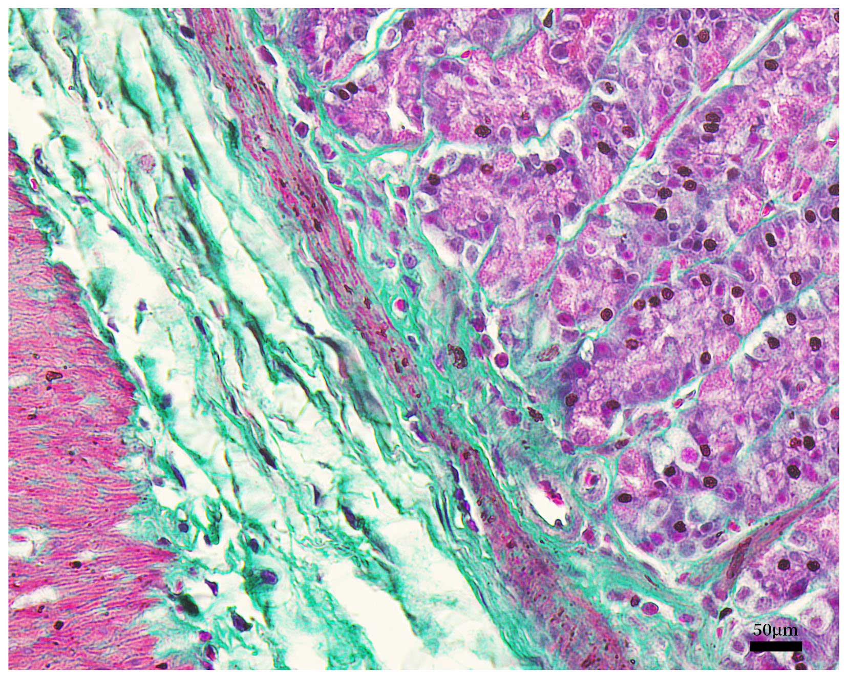 Masson's Trichrome Staining Kit